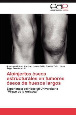 Aloinjertos Oseos Estructurales En Tumores Oseos de Huesos Largos (Paperback)