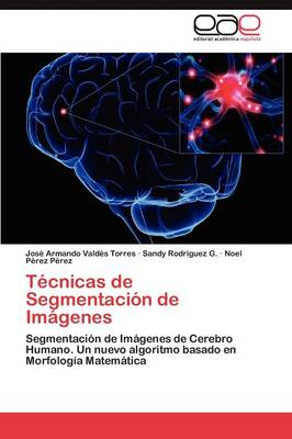 Tecnicas de Segmentacion de Imagenes (Paperback)