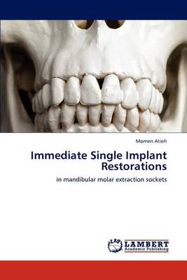 Immediate Single Implant Restorations (Paperback)