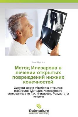 Metod Ilizarova V Lechenii Otkrytykh Povrezhdeniy Nizhnikh Konechnostey (Paperback)