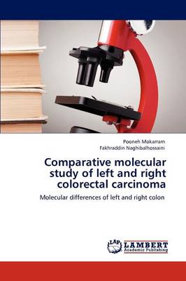 Comparative Molecular Study of Left and Right Colorectal Carcinoma (Paperback)