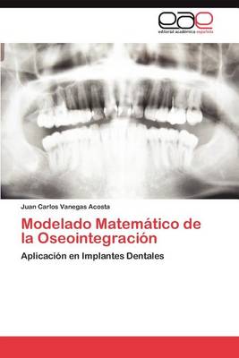 Modelado Matematico de la Oseointegracion (Paperback)