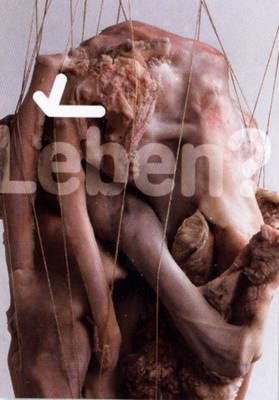 Leben?/Life?: Biomorphic Forms in Sculpture (Paperback)