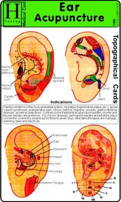 Ear Acupuncture - Medical Card