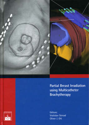 Partial Breast Irradiation Using Multicatheter Brachytherapy (Hardback)