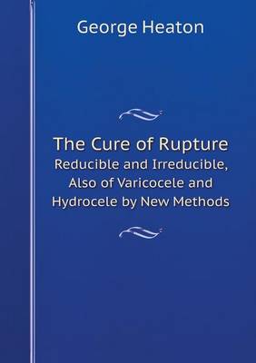 The Cure of Rupture Reducible and Irreducible, Also of Varicocele and Hydrocele by New Methods (Paperback)