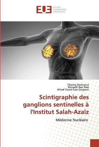 Scintigraphie des ganglions sentinelles a l'Institut Salah-Azaiz (Paperback)
