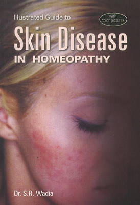 Illustrated Guide to Skin Disease in Homeopathy (Paperback)