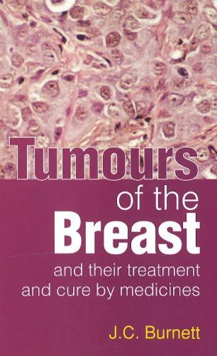Tumours of the Breast: & Their Treatment & Cure by Medicines (Paperback)