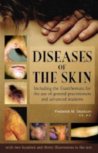 Diseases of the Skin: Including the Exanthemata for the Use of General Practitioners & Advanced Students (Hardback)