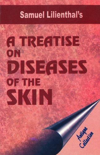 Treatise on Diseases of the Skin: Antique Collection (Paperback)