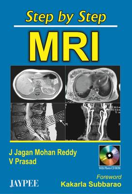 Step by Step MRI - Step by Step