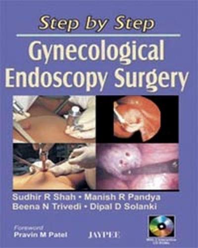 Step by Step: Gynecological Endoscopy Surgery - Step by Step