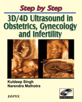 Step by Step: 3D and 4D Ultrasound in Obstetrics, Gynecology and Infertility - Step by Step