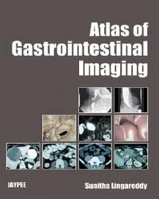 Atlas of Gastrointestinal Imaging (Hardback)