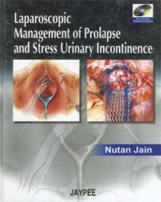 Laparoscopic Management of Prolapse and Stress Urinary Incontinence (Hardback)