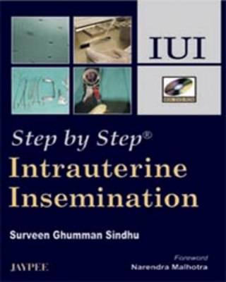 Step by Step: Intrauterine Insemination - Step by Step
