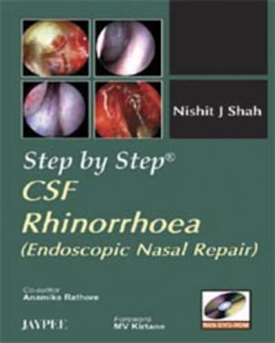 Step by Step: CSF Rhinorrhoea: Endoscopic Nasal Repair - Step by Step