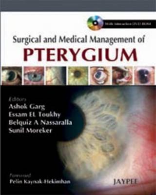 Surgical and Medical Management of Pterygium (Hardback)