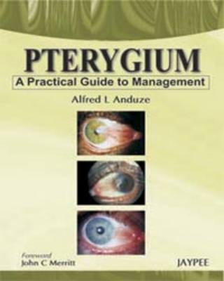 Pterygium - A Practical Guide to Management (Hardback)