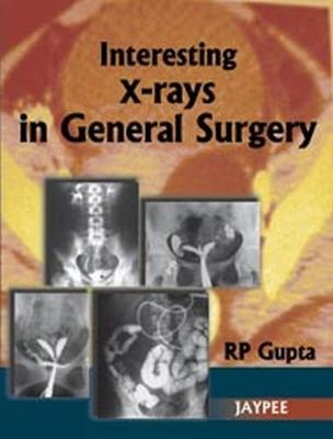 Interesting X-Rays in General Surgery (Paperback)