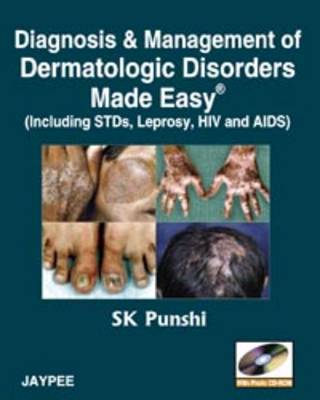 Diagnosis and Management of Dermatologic Disorders Made Easy: Including STDs, Leprosy, HIV and AIDs (Paperback)