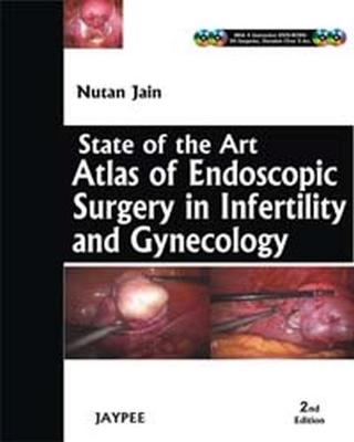 State-of-the-Art Atlas of Endoscopic Surgery in Infertility and Gynecology (Hardback)