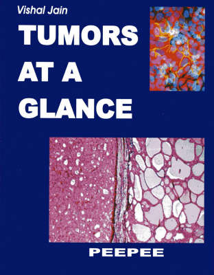 Tumors at a Glance: Volume 1 (Paperback)
