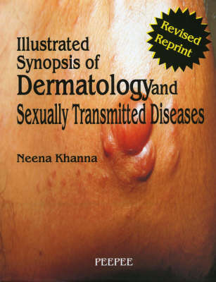 Illustrated Synopsis of Dermatology and Sexually Transmitted Diseases (Hardback)