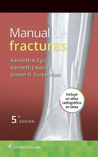 Manual de fracturas (Paperback)
