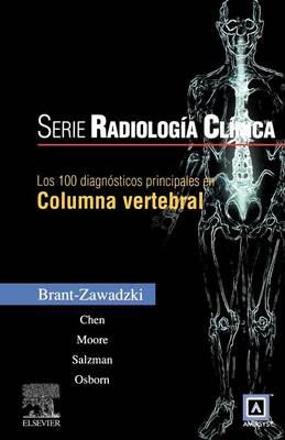 Los 100 Diagnosticos Principales En Columna Vertebral (Paperback)