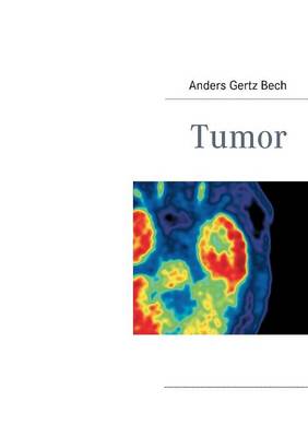 Tumor (Paperback)