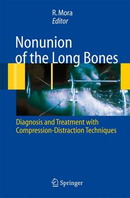 Nonunion of the Long Bones: Diagnosis and treatment with compression-distraction techniques (Hardback)