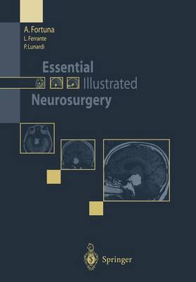 Essential Illustrated Neurosurgery (Paperback)