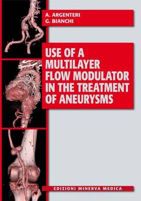 Use of a Multilayer Flow Modulator in the Treatment of Aneurysms (Paperback)