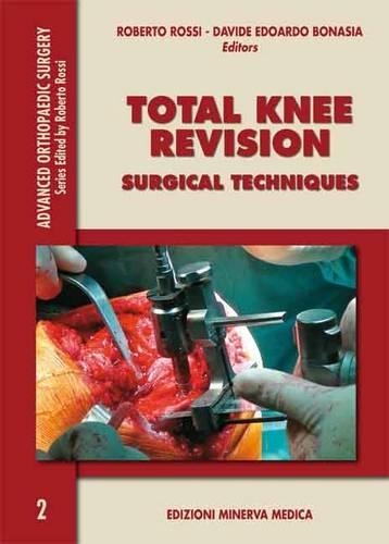 Total Knee Revision: Surgical Techniques - Advanced Orthopaedics Surgery 2 (Paperback)