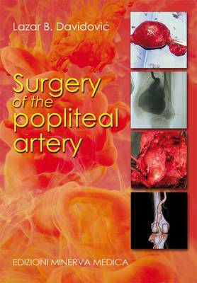 Surgery of the Popliteal Artery (Paperback)