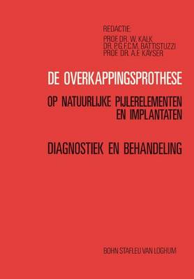 de Overkappingsprothese: Diagnostiek En Behandeling (Paperback)