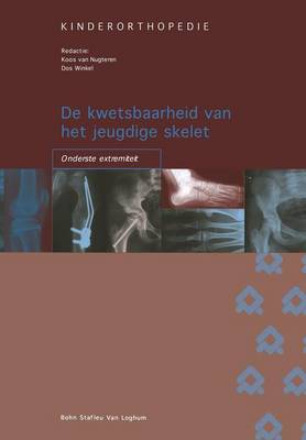 de Kwetsbaarheid Van Het Jeugdige Skelet: Onderste Extremiteit - Orthopedische Casuistiek (Paperback)