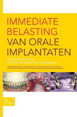 Immediate Belasting Van Orale Implantaten (Hardback)