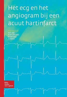 Het ECG En Het Angiogram Bij Een Acuut Hartinfarct (Paperback)