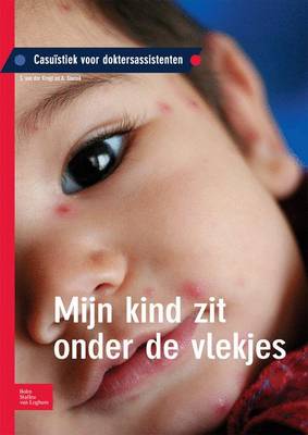 Mijn Kind Zit Onder de Vlekjes: Casu stiek Voor Doktersassistenten (Paperback)
