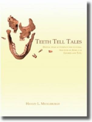 Teeth Tell Tales (Paperback)