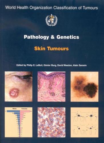 Pathology and genetics of skin tumours - World Health Organization Classification of Tumours 10 (Paperback)