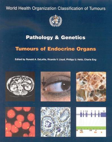 Pathology and genetics of tumours of the endocrine organs - World Health Organization Classification of Tumours 8 (Paperback)