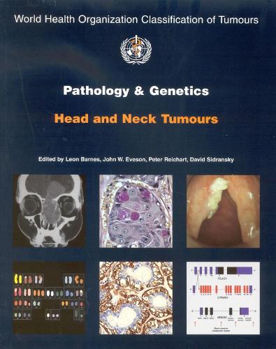 Pathology and genetics of head and neck tumours - World Health Organization Classification of Tumours (Paperback)