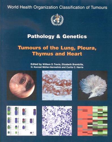 Pathology and genetics of tumours of the lung, plura, thymus and heart - World Health Organization Classification of Tumours 10 (Paperback)