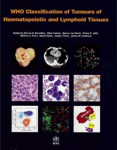WHO classification of tumours of haematopoietic and lymphoid tissues: Vol. 2: International Agency for Research on Cancer - WHO classification of tumours of haematopoietic and lymphoid tissues (Paperback)