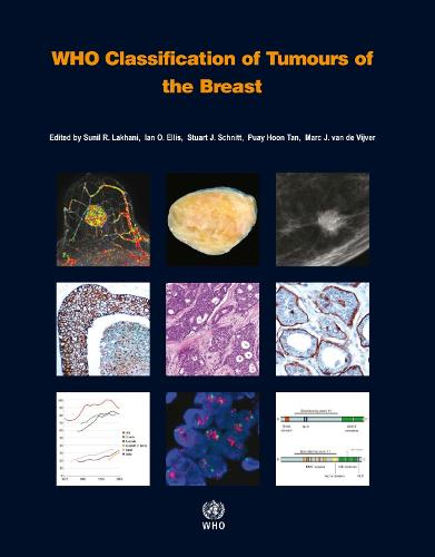 WHO classification of tumours of the breast - World Health Organization Classification of Tumours 4 (Paperback)