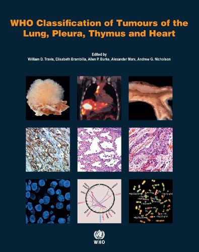 WHO classification of tumours of the lung, plura, thymus and heart - World Health Organization Classification of Tumours 7 (Paperback)